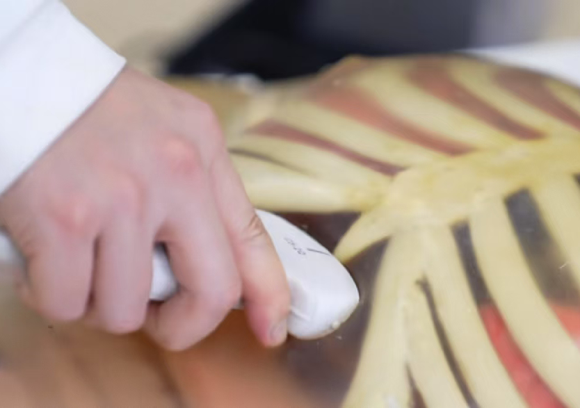 综合超声检查平台3.0