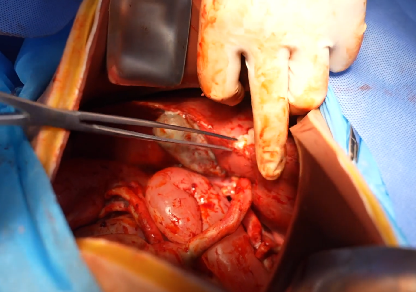 胸腹部损伤控制手术模拟人系统3.0